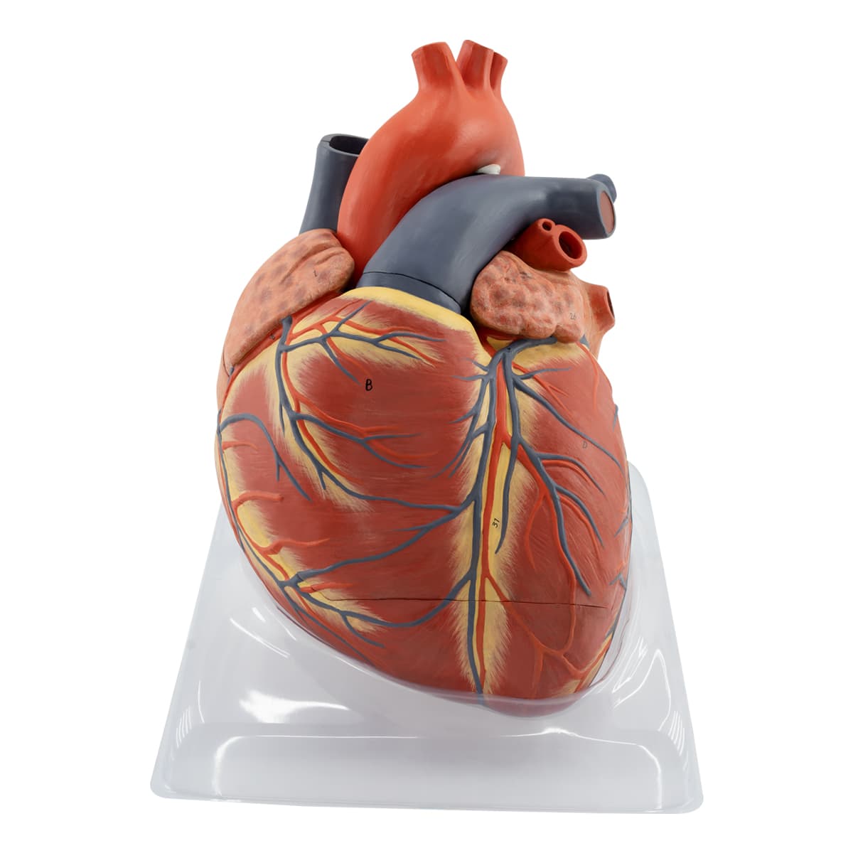 Enlarged Heart (KPH 02)